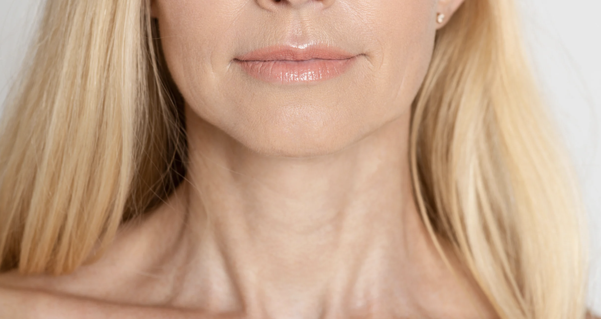 Neck Lift